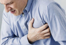 Infarto
