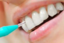 Dientes