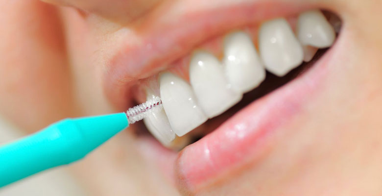 Dientes