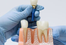 Dientes