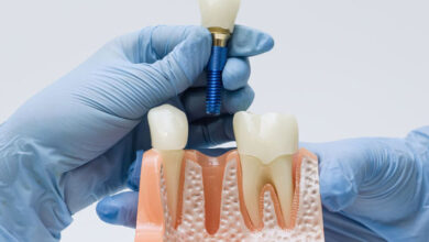 Dientes